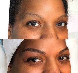 microblading before after dark skin petals laser lounge nyc