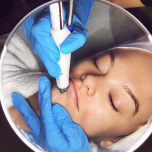 where to get hydrafacial and laser facial 